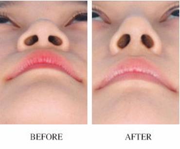 2023東莞非手術(shù)除皺塑形醫(yī)療美容醫(yī)院推薦，評分前10強(qiáng)震撼揭曉！