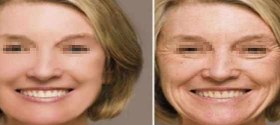 南寧祛斑專科醫(yī)院排行榜發(fā)布！十大最佳選擇！