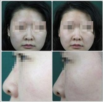 長(zhǎng)沙哪家整形醫(yī)院排名靠前，技術(shù)專業(yè)受用戶好評(píng)