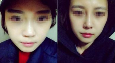 重慶治療腋臭效果好的醫(yī)院推薦