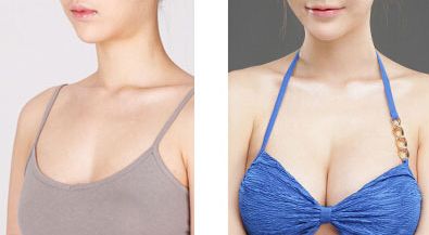 大連李爽矯治專家：隱形矯治、金屬托槽哪家好！