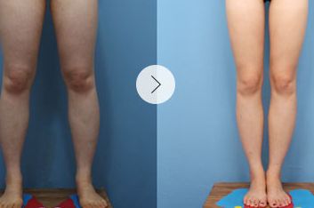 上海整容醫(yī)院排行：領(lǐng)先全球的磨骨技術(shù)，醫(yī)院評分驚人！