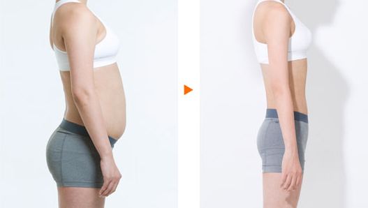 陳振宇的雙眼皮手術(shù)效果如何？在青醫(yī)附院的真實案例鑒賞提供參考