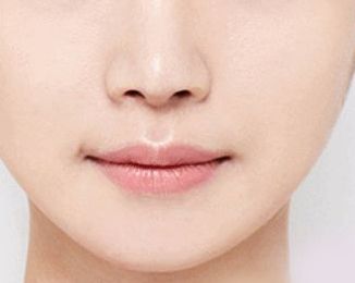 空軍總醫(yī)院眼袋手術(shù)費用及技術(shù)解析，醫(yī)師解讀+成功案例分享