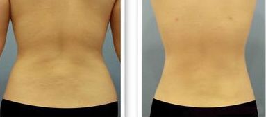 2023年溫州地區(qū)出現(xiàn)多位肋骨鼻醫(yī)生上榜！