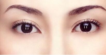 霍玉旺：中國鼻型塑造的頂尖大師！真實案例揭秘！