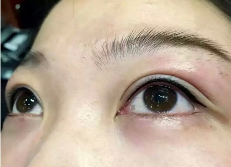 合肥華美整形外科醫(yī)院開展的特色項目有哪些？華美整形外科醫(yī)院真的靠譜嗎？