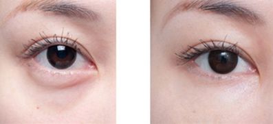 沈陽(yáng)整形醫(yī)院精心挑選，排名領(lǐng)先醫(yī)院揭曉