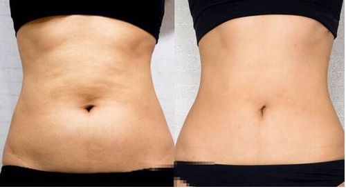 上海葉麗萍醫(yī)生進行鼻部整形效果如何？最新成功案例曝光