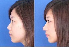 上海整形醫(yī)院排行榜前三資深專家力薦！整容技術(shù)卓越，名副其實(shí)！