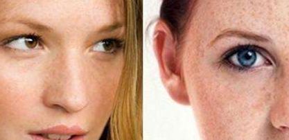 黃久佐醫(yī)生為你分享雙眼皮效果及技術測評！