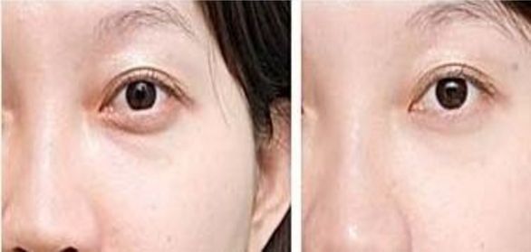 上海排名靠前的整形醫(yī)院推薦，想知道哪家好？最受歡迎的三甲醫(yī)療機構名單已公布！