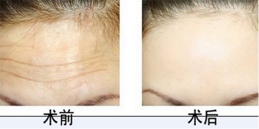 排行榜前十！沈陽(yáng)植發(fā)醫(yī)院技術(shù)高超有口碑