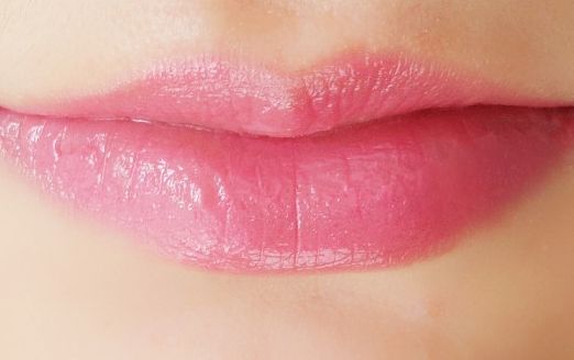 北京畫(huà)美醫(yī)院真實(shí)可靠嗎？親身吸脂歷程分享