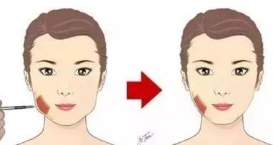 深圳整形圈熱門推薦！七位口碑高的假體豐臀醫(yī)生信息來襲！