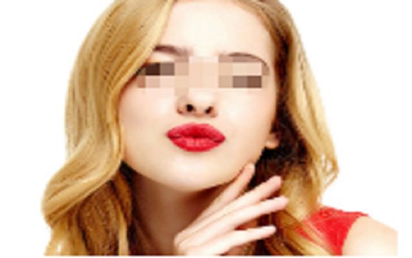 鄭州美萊枝蔓雙眼皮手術(shù)評(píng)價(jià)分享，價(jià)格公道有保障