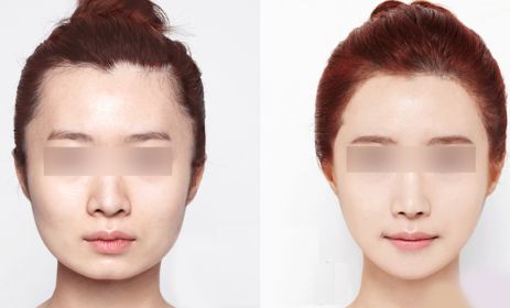 昆明哪里有最好的眼部手術(shù)整形醫(yī)院？2024年10家排名搶先曝光！