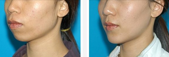 針對白做黃金微饒醫(yī)院選擇專家，哪處醫(yī)療中心值得信賴？