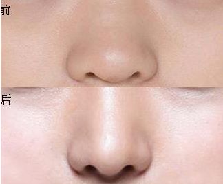 上海三甲整形醫(yī)院盤點！權(quán)威排行榜揭秘，實力在線！