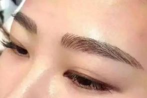 絕佳效果！體驗成都周維開刀雙眼皮的精彩案例