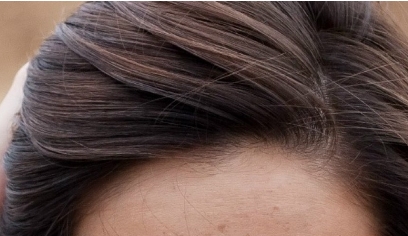 株洲愛思特醫(yī)療美容門診部有哪些擅長的項目推薦？