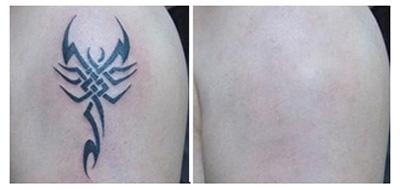 山西省整形外科醫(yī)院劉晉元好不好？割雙眼皮有何特色，值得信賴嗎？