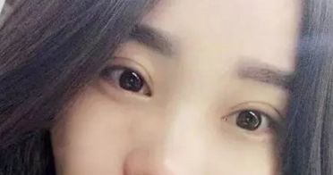 杭州最受贊譽(yù)的整容醫(yī)院整形手術(shù)效果揭秘