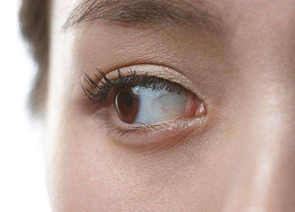 胡瓊?cè)A醫(yī)生：讓您雙眼皮煥然一新，聲譽卓越