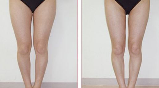 深圳市有哪些經(jīng)驗(yàn)豐富的脂肪填充醫(yī)生？Top五名單揭曉！