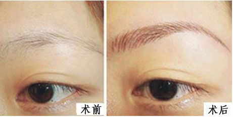 濰坊整形醫(yī)院排行榜揭曉！綜合評(píng)比推薦前五強(qiáng)熱門醫(yī)院，超值推薦！