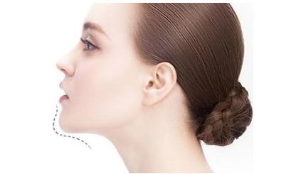 陸軍總院美容科：專家團(tuán)隊(duì)引領(lǐng)腰部吸脂，成功案例揭秘！