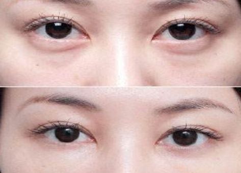 北京最受歡迎的整形醫(yī)院排名高居前三！私立醫(yī)美實力超越公立醫(yī)院！