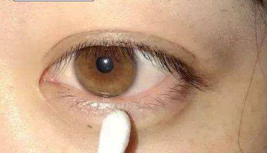 西京醫(yī)院：宋保強(qiáng)醫(yī)生主刀，隆胸手術(shù)安全可靠嗎？