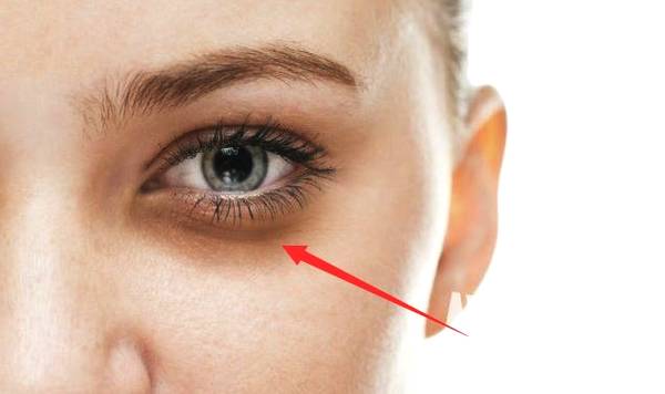 上海第一人民醫(yī)院整形科價格表——是這個夏天變美的理想選擇嗎？整形科去眼紋恢復效果如何呢？