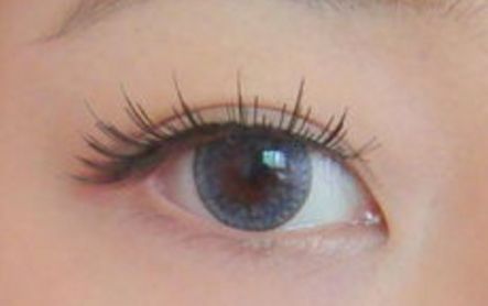 優(yōu)美雙眼輕松可得，了解樓善葉做雙眼皮的詳細(xì)過(guò)程和真實(shí)案例