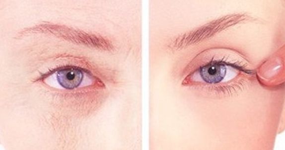 沈陽醫(yī)大二院美容整形科權(quán)威專家盛裝亮相，2023價格表曝光，丨真絕佳效果去眼袋案例讓人羨慕