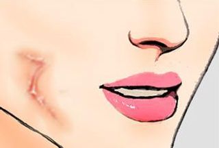 三亞心夢(mèng)醫(yī)學(xué)劉濤醫(yī)生揭秘，無(wú)創(chuàng)吸脂實(shí)踐案例分享及收費(fèi)解析！