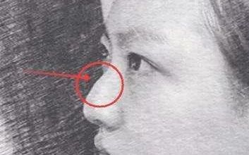 合肥雙眼皮整形醫(yī)院推薦：探尋當?shù)?家口碑佳的醫(yī)美機構