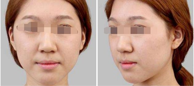 2024年長沙祛胎記整形醫(yī)院哪家技術(shù)好