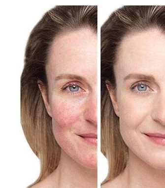 【長(zhǎng)春市】?jī)?yōu)質(zhì)整容醫(yī)院推薦！匯總前五家大熱門(mén)名單揭曉