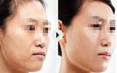 2024年大連優(yōu)質(zhì)整形醫(yī)院排行榜出爐，讓您輕松找到靠譜整形醫(yī)院