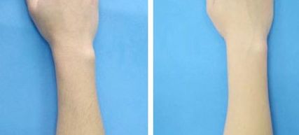 國內(nèi)哪些醫(yī)生做雙眼皮好？王曉亞、李燕、張穎熱門前五推薦！(2023價格表附)