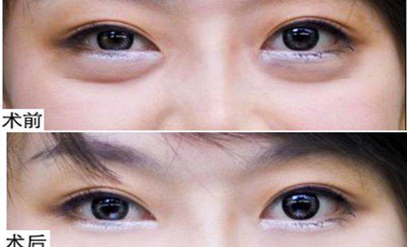 揭曉！鄭州2023年首屈一指的鼻部整形名醫(yī)TOP10震撼排行出爐