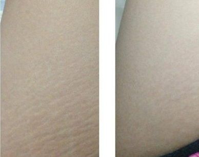 成都哪家醫(yī)院2023熱門雙眼皮全切推薦，醫(yī)院名單及簡(jiǎn)介全解析！