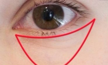 長(zhǎng)沙優(yōu)秀的雙眼皮修復(fù)醫(yī)生，找到周芳醫(yī)生和李超醫(yī)生