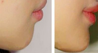 鄭州鼻部整形名醫(yī)盤(pán)點(diǎn)！權(quán)威醫(yī)生七人班底完美曝光