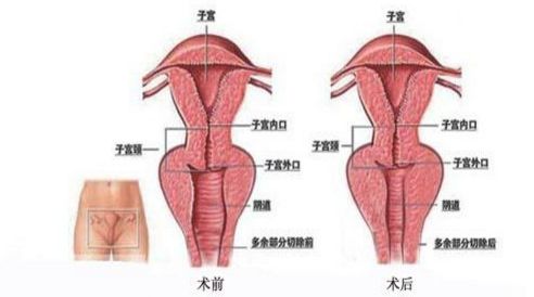 上海祛斑哪家醫(yī)院技術專業(yè)，效果有保障