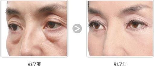 西安地區(qū)醫(yī)美整形醫(yī)院綜合排名匯總，強(qiáng)力醫(yī)療機(jī)構(gòu)數(shù)據(jù)大公開(kāi)