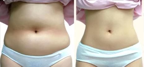 重慶五家聲譽良好的整形醫(yī)院公布，私立醫(yī)療機構(gòu)值得考慮