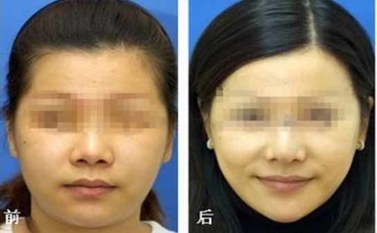 昆明乳房整形哪家醫(yī)院專業(yè)可信？榜單前五推薦，選你中意的